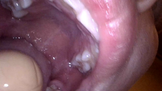 Yuri - Egg Eating - Internal Mouth View (Endoscopy)