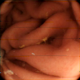 Yuri Internal Journey A Capsule Endoscopy Full Tour