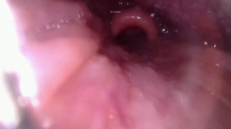 Rena's Mouth And Throat Exploration 1